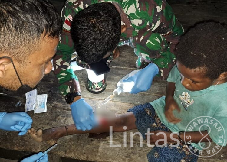 Aksi Cepat Tim Kesehatan Satgas Yonif 310/KK Berikan Pertolongan Kepada Seorang Anak