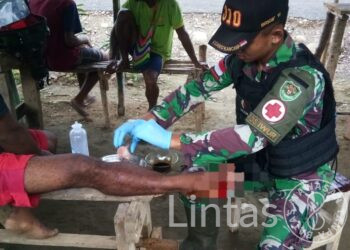 Alami Luka Robek Terkena Kapak, Albertinus Kasipmabin Diobati Tim Kesehatan Yonif 310/KK