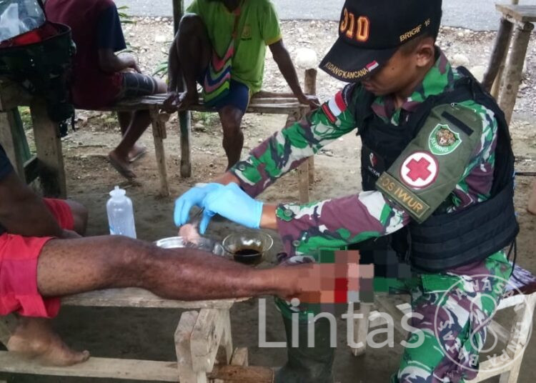 Alami Luka Robek Terkena Kapak, Albertinus Kasipmabin Diobati Tim Kesehatan Yonif 310/KK