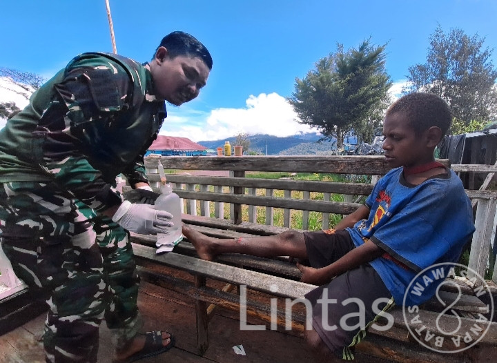 Prajurit Habema Sigap Obati Anak Emondi Luka Main Bola