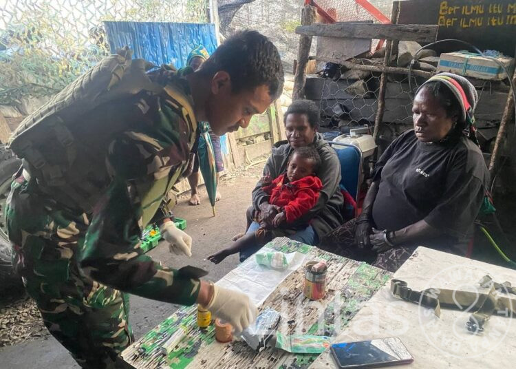 Satgas TNI Tangani Bayi 1 Tahun Yang Kakinya Terkena Api di Honai